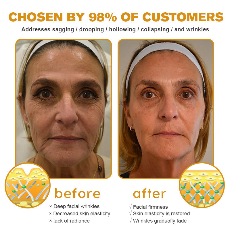 Official Store | Instant FirmXBOTOX Easy Wear Temporary Eye Tightener with Collagen, Bee venom & Matrixyl 3000, Free brush🔥
